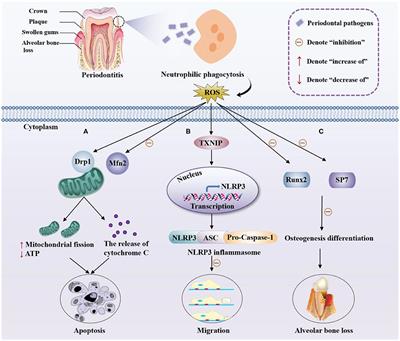 ROS-Scavenging Nanomaterials to Treat Periodontitis